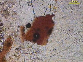 Biotite LPNA